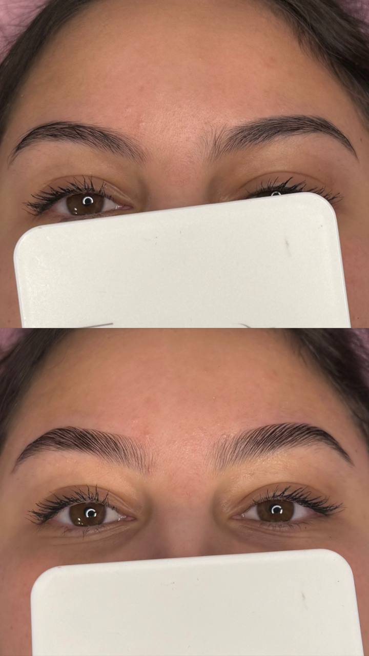 Brow Lift avant après Toulouse - Ysglow