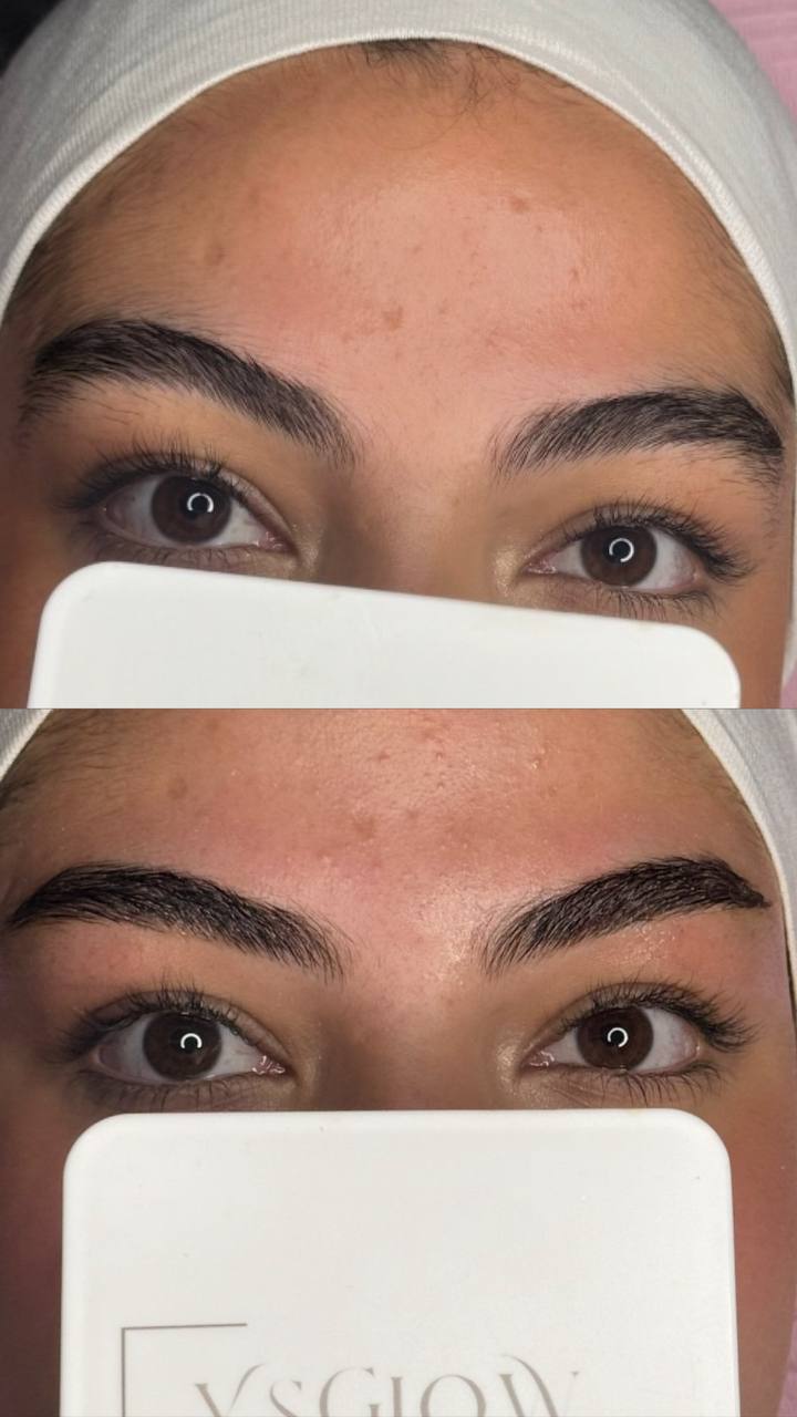 Restructuration sourcils avant après Toulouse - Ysglow
